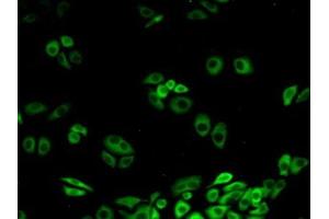 Detection of CACYBP in Human Hela Cells using Polyclonal Antibody to Calcyclin Binding Protein (CACYBP) (CACYBP Antikörper  (AA 2-228))