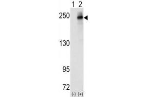 Western blot analysis of ALK antibody and 293 cell lysate (2 ug/lane) either nontransfected (Lane 1) or transiently transfected with the human gene (2). (ALK Antikörper  (AA 636-666))