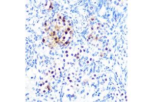 Immunohistochemistry (IHC) image for anti-Microphthalmia-Associated Transcription Factor (MITF) antibody (ABIN7268511)
