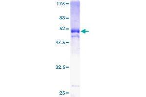 Image no. 1 for Kruppel-Like Factor 6 (KLF6) (AA 1-260) protein (GST tag) (ABIN1308760) (KLF6 Protein (AA 1-260) (GST tag))