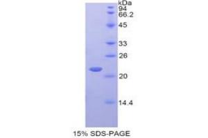 SDS-PAGE analysis of Rat Interferon alpha 4 Protein.
