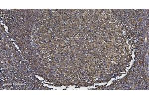 IHC analysis of MEF2C using anti-MEF2C antibody (ABIN6719606).