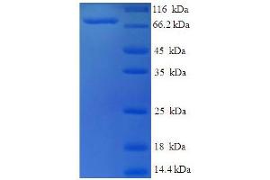 SDS-PAGE (SDS) image for Set1/Ash2 Histone Methyltransferase Complex Subunit ASH2 (ASH2L) (AA 1-534), (Isoform 3) protein (His-SUMO Tag) (ABIN4976222)