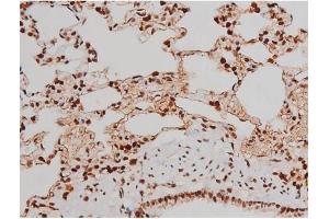 ABIN6267365 at 1/200 staining Rat lung tissue sections by IHC-P.
