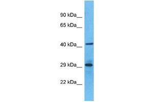 Western Blotting (WB) image for anti-Olfactory Receptor, Family 6, Subfamily S, Member 1 (OR6S1) (C-Term) antibody (ABIN2791769) (OR6S1 Antikörper  (C-Term))