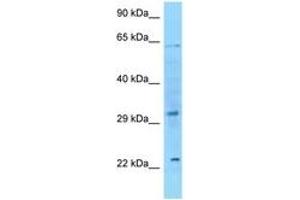 Image no. 1 for anti-Fibroblast Growth Factor 8 (Androgen-Induced) (FGF8) (C-Term) antibody (ABIN6748244) (FGF8 Antikörper  (C-Term))