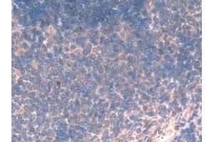 Immunohistochemistry (IHC) image for anti-Pro-Platelet Basic Protein (Chemokine (C-X-C Motif) Ligand 7) (PPBP) (AA 46-107) antibody (ABIN7431665)