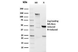 SDS-PAGE Analysis Purified Lambda Light Chain Recombinant Rabbit Monoclonal (LLC/3778R). (Rekombinanter IgL Antikörper)