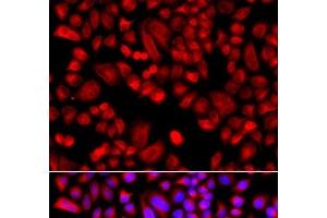 Immunofluorescence analysis of A549 cells using ARPC3 Polyclonal Antibody (ARPC3 Antikörper)