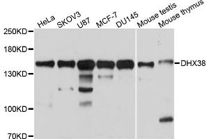 Western blot analysis of extracts of various cell lines, using DHX38 antibody. (DHX38 Antikörper)