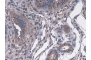 Detection of CYP-40 in Mouse Uterus Tissue using Polyclonal Antibody to Cyclophilin 40 (CYP-40)