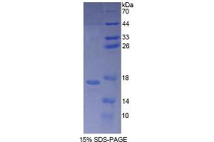 SDS-PAGE (SDS) image for Eukaryotic Translation Initiation Factor 2D (EIF2D) (AA 1-117) protein (His tag) (ABIN4989359)