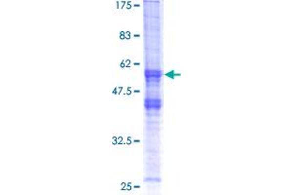 XRCC2 Protein (AA 1-280) (GST tag)