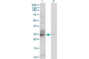 Western Blotting (WB) image for anti-Chromosome 21 Open Reading Frame 33 (C21orf33) (AA 188-269) antibody (ABIN599034) (C21orf33 Antikörper  (AA 188-269))