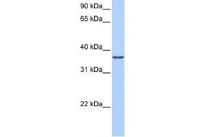 WB Suggested Anti-VGLL2 Antibody Titration:  0. (VGLL2 Antikörper  (Middle Region))