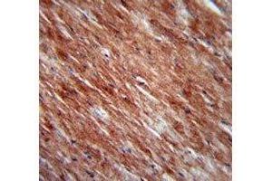IL-2 antibody immunohistochemistry analysis in formalin fixed and paraffin embedded mouse heart tissue. (IL-2 Antikörper  (AA 50-77))