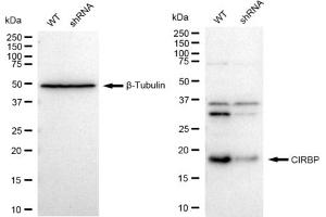 Western blotting analysis using CIRBP antibody (ABIN7798120). (Rekombinanter CIRBP Antikörper)