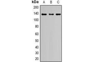 Western blot analysis of Nephrin expression in HeLa (A), HEK293T (B), PC12 (C) whole cell lysates. (Nephrin Antikörper  (C-Term))