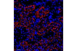 Immunofluorescence of paraffin embedded rat kidney using SLC22A12 (ABIN7075662) at dilution of 1:2000 (300x lens) (SLC22A12 Antikörper)
