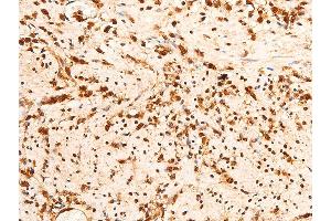 Immunohistochemistry (IHC) image for anti-Checkpoint Kinase 2 (CHEK2) (pThr383) antibody (ABIN6256552)
