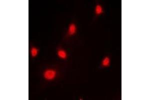 Immunofluorescence (IF) image for anti-Heterogeneous Nuclear Ribonucleoprotein L (HNRNPL) antibody (ABIN7303818)