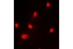 Immunofluorescent analysis of hnRNP L staining in HeLa cells. (HNRNPL Antikörper)