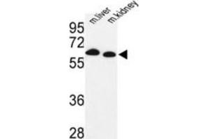 Western Blotting (WB) image for anti-Proline Dehydrogenase (Oxidase) 1 (PRODH) antibody (ABIN3003837) (PRODH Antikörper)