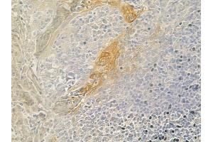 ABIN6260768 and ABIN6279276 at 1/100 staining human normal tonsil tissue by IHC-P. (CEP41 Antikörper  (Internal Region))