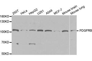 Western blot analysis of extracts of various cell lines, using PDGFRB antibody. (PDGFRB Antikörper  (AA 887-1106))