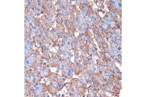 Immunohistochemistry of paraffin-embedded human liver using Alpha Fodrin Rabbit mAb (ABIN7270518) at dilution of 1:100 (40x lens). (SPTAN1 Antikörper)