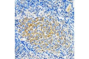 Immunohistochemistry of paraffin-embedded rat ovary using SIRT2 antibody (ABIN5970103) at dilution of 1/100 (40x lens). (SIRT2 Antikörper)