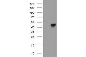 Western Blotting (WB) image for anti-Leucine Rich Repeat Containing 25 (LRRC25) antibody (ABIN1499200) (LRRC25 Antikörper)