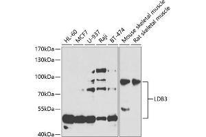 Western blot analysis of extracts of various cell lines, using LDB3 antibody (ABIN6128179, ABIN6143125, ABIN6143126 and ABIN6223347) at 1:1000 dilution. (LIM Domain Binding 3 Protein Antikörper  (AA 1-283))