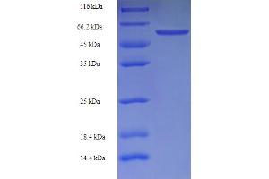 SDS-PAGE (SDS) image for Luteinizing Hormone/Choriogonadotropin Receptor (LHCGR) (AA 27-362) protein (His-SUMO Tag) (ABIN5709857)