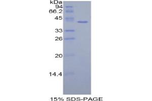 SDS-PAGE analysis of Human HIST1H2AH Protein.
