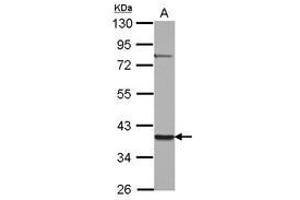 Image no. 1 for anti-Zinc Finger Protein 302 (ZNF302) (AA 1-178) antibody (ABIN1501835) (ZNF302 Antikörper  (AA 1-178))
