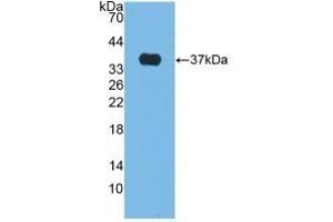 Detection of Recombinant ALP, Bovine using Polyclonal Antibody to Alkaline Phosphatase (ALP) (Alkaline Phosphatase Antikörper)