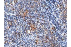 Image no. 1 for anti-rho GTPase Activating Protein 25 (ARHGAP25) antibody (ABIN1496701) (ARHGAP25 Antikörper)