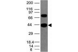 Western blot of human SKM tissue lysate using pan Muscle Actin antibody (Pan Muscle Actin Antikörper)