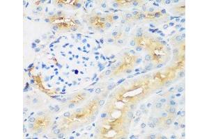 Immunohistochemistry of paraffin-embedded Rat kidney using PROCR Polyclonal Antibody at dilution of 1:200 (40x lens). (PROCR Antikörper)