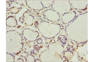 Immunohistochemistry of paraffin-embedded human thyroid tissue using ABIN7175755 at dilution of 1:100 (WDR47 Antikörper  (AA 350-600))