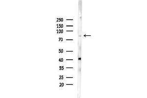 anti-Methylmalonyl Coenzyme A Mutase (MUT) (N-Term) antibody