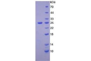 SDS-PAGE analysis of Human PTK7 Protein. (PTK7 Protein)