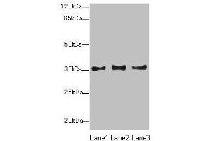 Western blot All lanes: NUP35 antibody at 12 μg/mL Lane 1: Jurkat whole cell lysate Lane 2: A431 whole cell lysate Lane 3: HepG2 whole cell lysate Secondary Goat polyclonal to rabbit IgG at 1/10000 dilution Predicted band size: 35, 34, 22 kDa Observed band size: 35 kDa (NUP35 Antikörper  (AA 6-305))