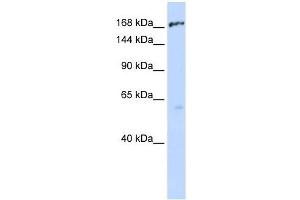 ABCC1 antibody used at 1 ug/ml to detect target protein.