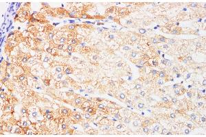 Immunohistochemistry of paraffin-embedded Human liver using IFNAR1 Polyclonl Antibody at dilution of 1:200. (IFNAR1 Antikörper)
