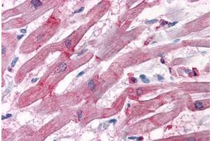 Human Heart: Formalin-Fixed, Paraffin-Embedded (FFPE) (BAG3 Antikörper  (AA 563-575))