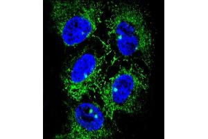 Confocal immunofluorescent analysis of ADH7 Antibody (C-Term) (ABIN653658 and ABIN2842998) with NCI- cell followed by Alexa Fluor® 488-conjugated goat anti-rabbit lgG (green).