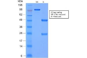 SDS-PAGE (SDS) image for anti-Matrix Metallopeptidase 3 (Stromelysin 1, Progelatinase) (MMP3) antibody (ABIN6940070)