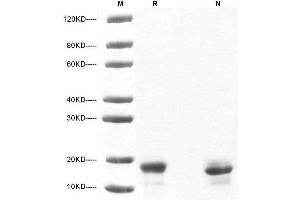 5 μg of IL-10, Human  was resolved with SDS-PAGE under reducing (R) and non-reducing (N) conditions and visualized by Coomassie Blue staining. (IL-10 Protein (AA 19-178))